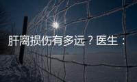 肝離損傷有多遠(yuǎn)？醫(yī)生：這些藥物若亂吃，肝功能一天不如一天