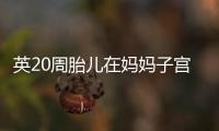英20周胎兒在媽媽子宮豎大拇指 走紅網絡