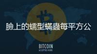 臉上的蠕型蟎蟲每平方公分有11、12隻正常，超過恐引起酒糟性皮膚炎
