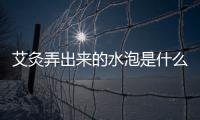 艾灸弄出來的水泡是什么 艾灸的水泡需不需要弄破