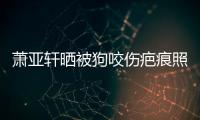 蕭亞軒曬被狗咬傷疤痕照：臉細胞壞死還在養皮