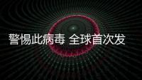 警惕此病毒 全球首次發現人被感染