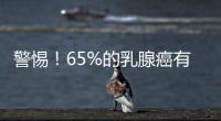 警惕！65%的乳腺癌有鈣化 鈣化是癌變的信號