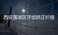 西安蓮湖區牙齒矯正價格:參考西安蓮湖區正畸比較好的牙科費用