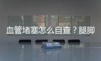 血管堵塞怎么自查？腿腳告訴你答案