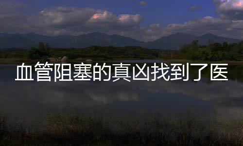 血管阻塞的真兇找到了醫師主張堅持5點血管越來越曉暢