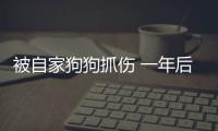 被自家狗狗抓傷 一年后小伙狂犬病發作身亡