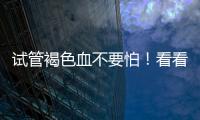 試管褐色血不要怕！看看醫(yī)生說的移植后褐色分泌物是什么