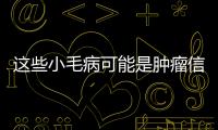 這些小毛病可能是腫瘤信號(hào) 要多加留意 收了