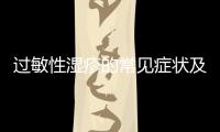 過敏性濕疹的常見癥狀及治療方法