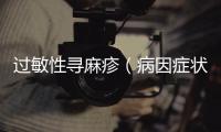 過敏性尋麻疹（病因癥狀和治療方法）
