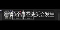 連續3個月不洗頭會發生什么？提醒：洗頭時，這些細節尤為注意