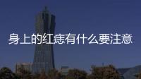 身上的紅痣有什么要注意的嗎