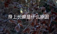 身上長癬是什么原因
