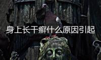 身上長干癬什么原因引起的？身上長干癬什么原因造成的