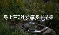 身上若2處發(fā)癢多半是糖尿病躍躍欲試
