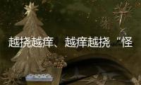 越撓越癢、越癢越撓“怪圈”解開