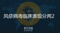 風疹病毒臨床表現分兩2種,先天
