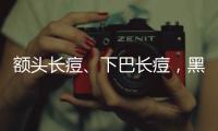 額頭長痘、下巴長痘，黑眼圈是怎么回事，原來都和這件事有關