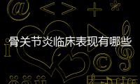 骨關節炎臨床表現有哪些 關節疼痛是最突出的癥狀
