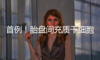 首例！胎盤間充質(zhì)干細(xì)胞治療創(chuàng)傷視神經(jīng)病變 臨床結(jié)果顯著