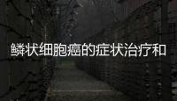 鱗狀細胞癌的癥狀治療和預防方法詳解