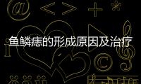 魚鱗痣的形成原因及治療方法,魚鱗痣的危害和預防措施