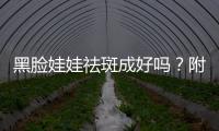 黑臉娃娃祛斑成好嗎？附費用及注意事項