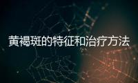 黃褐斑的特征和治療方法詳解