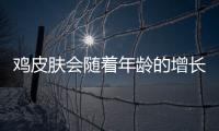 雞皮膚會隨著年齡的增長消除嗎 雞皮膚用什么藥膏最好