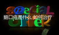 鵝口瘡是什么 如何治療鵝口瘡