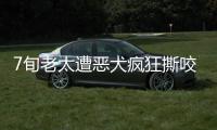7旬老太遭惡犬瘋狂撕咬 險喪命