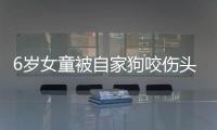 6歲女童被自家狗咬傷頭面部 因為她做了這個