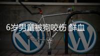 6歲男童被狗咬傷 鮮血直流