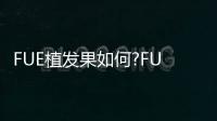 FUE植發果如何?FUE植發發際線果圖