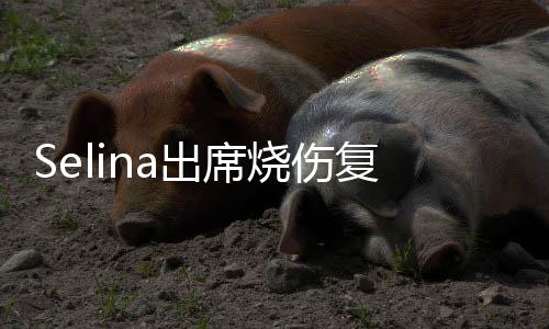 Selina出席燒傷復(fù)健公益活動(dòng) 現(xiàn)場(chǎng)透露幸福秘訣