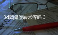 3d顴骨旋轉(zhuǎn)術(shù)疼嗎 3d顴骨旋轉(zhuǎn)術(shù)風(fēng)險(xiǎn)大嗎