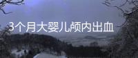 3個(gè)月大嬰兒顱內(nèi)出血 醫(yī)生：摟抱搖晃惹的禍