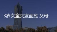 3歲女童突發(fā)面癱 父母還以為她在做鬼臉
