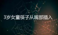 3歲女童筷子從嘴部插入小腦險喪命
