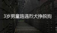 3歲男童路遇烈犬掙脫狗繩撕咬傷口多達近10處