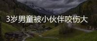 3歲男童被小伙伴咬傷大哭 雙方家長趕來大打出手