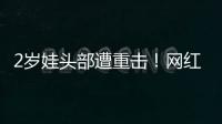 2歲娃頭部遭重擊！網紅產品被曝缺陷……已有多人受傷