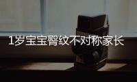 1歲寶寶臀紋不對稱家長上網搜索后嚇哭 專家：正常