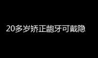 20多歲矯正齙牙可戴隱形牙套,能補貼6000元還送一幅保持器哦