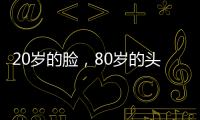 20歲的臉，80歲的頭發，年輕人出現白頭發，原因不只是熬夜